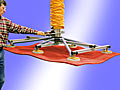 ANVER Vacuum Tube Lifter with Special Six Pad Attachment